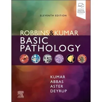 Robbins & Kumar Basic Pathology. (Vinay Kumar,Abul K. Abbas,Jon C. Aster,Andrea T Deyrup)(Pevná)