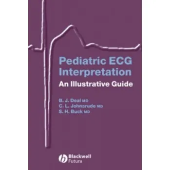 Pediatric ECG Interpretation - An Illustrative Guide (Barbara J. Deal,Christopher L. Johnsrude,Scott H. Buck)(Brožovaná)