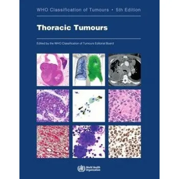 Cizojazyčná kniha Thoracic Tumours: Who Classification of Tumours (Brožovaná)
