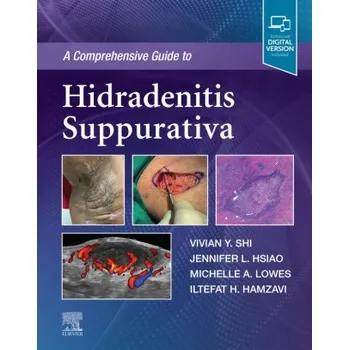 Comprehensive Guide to Hidradenitis Suppurativa (Vivian Y. Shi,Jennifer L. Hsiao,Michelle Lowes,Iltefat Hamzavi)(Pevná)