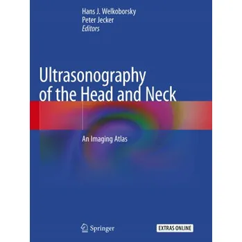 Cizojazyčná kniha Ultrasonography of the Head and Neck: An Imaging Atlas (Hans J. Welkoborsky,Peter Jecker)(Brožovaná)