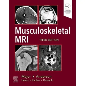 Musculoskeletal MRI (NANCY M. MAJOR)(Pevná)