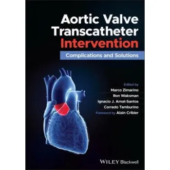Učebnice Aortic Valve Transcatheter Intervention (Ron Waksman,Ignacio Amat-Santos)(Pevná)