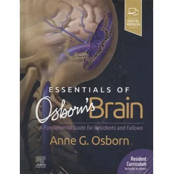 Essentials of Osborn's Brain (Anne G. Osborn)(Pevná)
