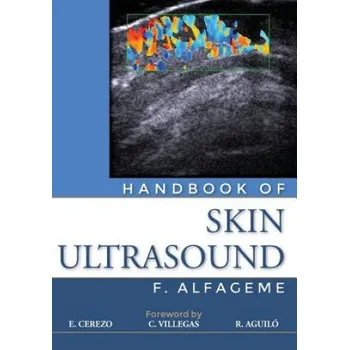 Handbook of Skin Ultrasound (Dr Fernando Alfageme,Dr E Cerezo)(Brožovaná)