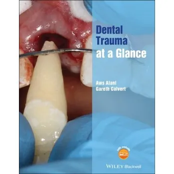 Dental Trauma at a Glance - Alani, Aws; Calvert, Gareth
