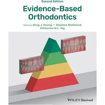 Evidence-Based Orthodontics 2e – Greg J Huang (EN)
