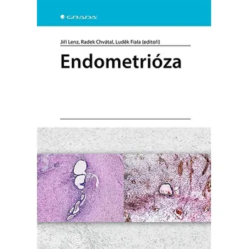 Kniha Endometrióza Ekniha