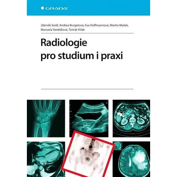 Kniha Radiologie pro studium i praxi Ekniha