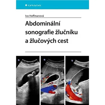 Abdominální sonografie žlučníku a žlučových cest Kniha