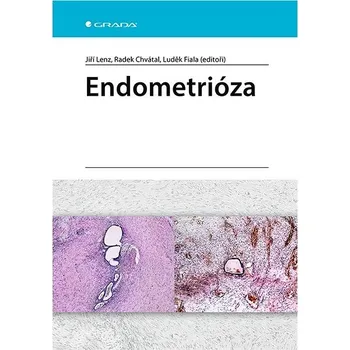 Endometrióza Kniha