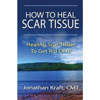 Učebnice How to Heal Scar Tissue: How to Heal Your Own Scar Tissue And Get Rid Of It! (Jonathan a Kraft)(Brožovaná)