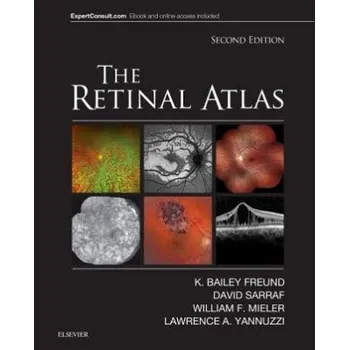Retinal Atlas (K. Bailey Freund,David Sarraf,William F. Mieler,Lawrence A. Yannuzzi)(Pevná)