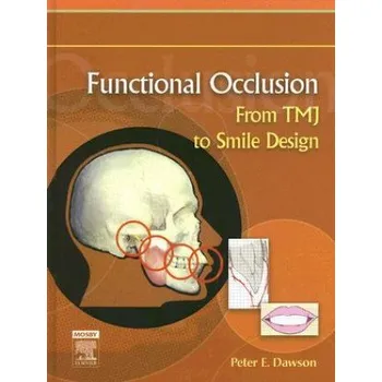 Functional Occlusion (Peter E. Dawson)(Pevná)
