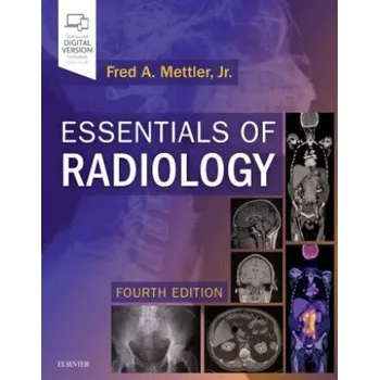 Essentials of Radiology (Fred A. Mettler)(Brožovaná)