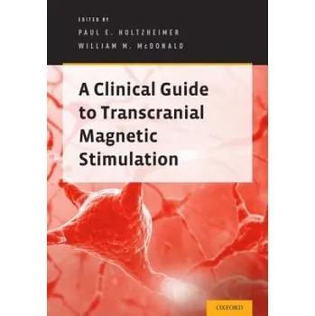Clinical Guide to Transcranial Magnetic Stimulation (Paul E. Holtzheimer)(Brožovaná)