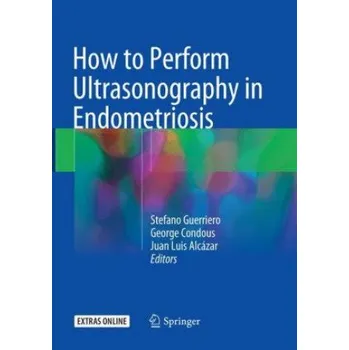 Cizojazyčná kniha How to Perform Ultrasonography in Endometriosis (Stefano Guerriero,George Condous,Juan Luis Alcázar)(Brožovaná)