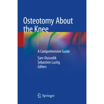 Cizojazyčná kniha Osteotomy About the Knee (Sam Oussedik)(Brožovaná)