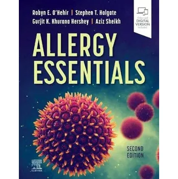 Allergy Essentials (Robyn E O'Hehir,Stephen T Holgate,Gurjit K. Khurana Hershey,Aziz Sheikh)(Pevná)