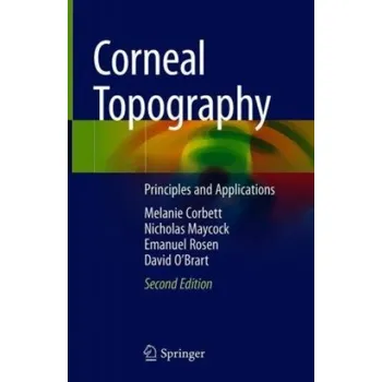 Cizojazyčná kniha Corneal Topography (Melanie Corbett,Nicholas Maycock,Emanuel Rosen,David O'Brart)(Pevná)