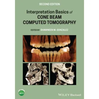 Učebnice Interpretation Basics of Cone Beam Computed Tomography (Pevná)