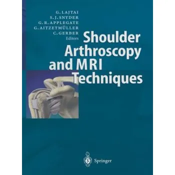 Cizojazyčná kniha Shoulder Arthroscopy and MRI Techniques (Georg Lajtai,Stephen J. Snyder,Gregory Applegate,Gernot Aitzetmüller,Christian Gerber)(Brožovaná)