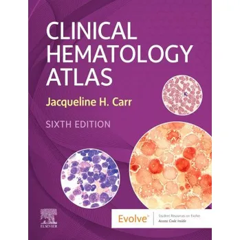 Clinical Hematology Atlas (Jacqueline H. Carr)(Kroužková)