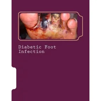 Cizojazyčná kniha Diabetic Foot Infection (Dr Romana Ayub,MR Syed Shahmeer Raza)(Brožovaná)