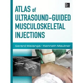 Cizojazyčná kniha Atlas of Ultrasound-Guided Musculoskeletal Injections (Gerard Malanga)(Pevná)