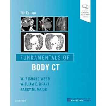 Fundamentals of Body CT (W. Richard Webb)(Brožovaná)
