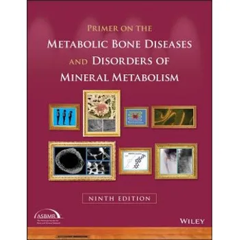 Cizí jazyk Primer on the Metabolic Bone Diseases and Disorders of Mineral Metabolism, 9th Edition (Clifford J. Rosen)(Brožovaná)