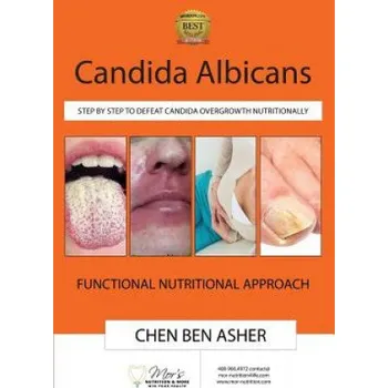 Učebnice Candida Albicans: Step by Step to Defeat Candida Overgrowth Nutritionally (Chen Ben Asher)(Brožovaná)