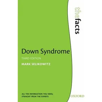 Cizojazyčná kniha Down Syndrome (Mark Selikowitz)(Brožovaná)