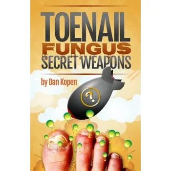 Učebnice Toenail Fungus Secret Weapons: Uncover over 14 toenail fungus treatments that you can combine to clear your toe nails in under 45 days! (Dan Kopen)(Brožovaná)