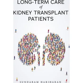Český jazyk Long-Term Care of Kidney Transplant Patients (Brožovaná)