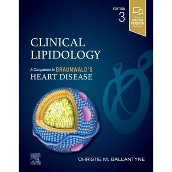 Clinical Lipidology (Christie M. Ballantyne)(Pevná)