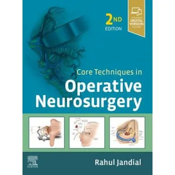 Core Techniques in Operative Neurosurgery (Mccormic,Black,Jandial)(Pevná)
