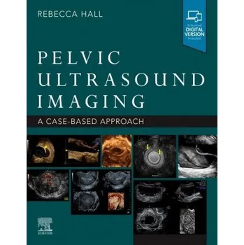 Pelvic Ultrasound Imaging (Rebecca Hall)(Brožovaná)
