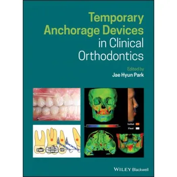 Cizí jazyk Temporary Anchorage Devices in Clinical Orthodontics (Jae Hyun Park)(Pevná)