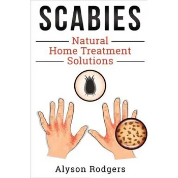Cizí jazyk Scabies Natural Home Treatment Solution (Alyson Rodgers)(Brožovaná)