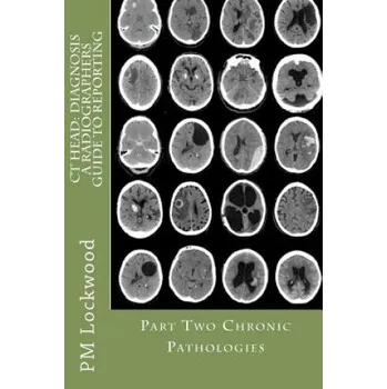 CT Head: DIAGNOSIS A Radiographers Guide To Reporting Part 2 Chronic Pathologies: Part 2 Chronic Pathologies (P M Lockwood)(Brožovaná)