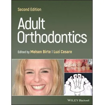 Adult Orthodontics 2nd Edition (Pevná)