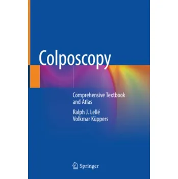 Cizojazyčná kniha Colposcopy: Comprehensive Textbook and Atlas (Ralph J. Lellé,Volkmar Küppers)(Pevná)