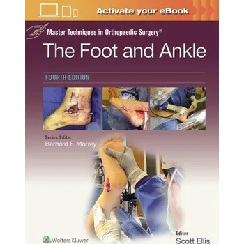 Master Techniques in Orthopaedic Surgery: The Foot and Ankle (SCOTT ELLIS)(Pevná)