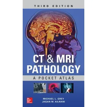 Učebnice CT & MRI Pathology: A Pocket Atlas, Third Edition (Jagan Mohan Ailinani,Michael L. Grey)(Brožovaná)