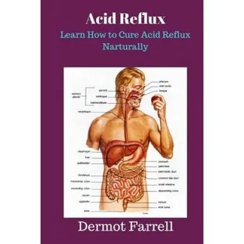 Cizojazyčná kniha Acid Reflux: Learn How to Cure Acid Reflux Naturally (MR Dermot Farrell)(Brožovaná)