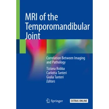 Cizojazyčná kniha MRI of the Temporomandibular Joint: Correlation Between Imaging and Pathology (Tiziana Robba,Carlotta Tanteri,Giulia Tanteri)(Brožovaná)