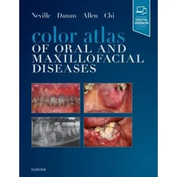 Color Atlas of Oral and Maxillofacial Diseases (Neville,Brad W.,DDS,Douglas D. Damm,Carl M. Allen,Angela C. Chi)(Pevná)