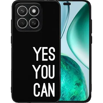 Příslušenství pro tablet VSECHNONAMOBIL 115304 MY ART Ochranný kryt pro Honor X8c YOU CAN (171)