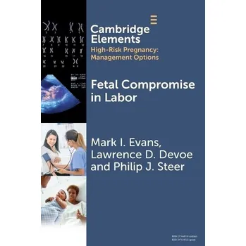 Cizojazyčná kniha Fetal Compromise in Labor - Evans, Mark I. (Icahn School of Medicine at Mount Sinai, New York and Yong Loo Lin School of Medicine, National University of Singapore) a Devoe, Lawrence D. (Medical College of Georgia at Augusta University) a Steer, Philip J.